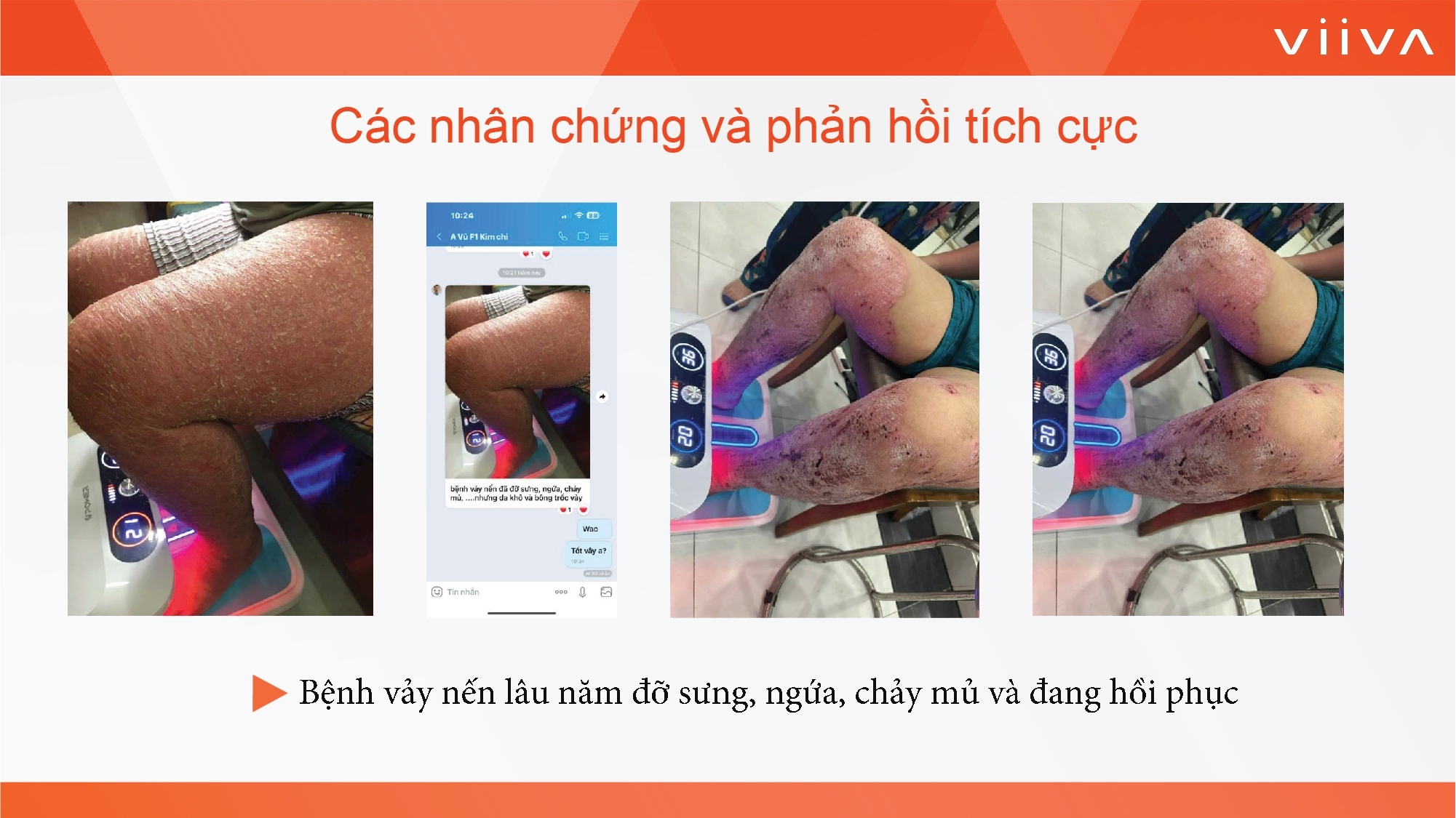 Sản phẩm Sản phẩm