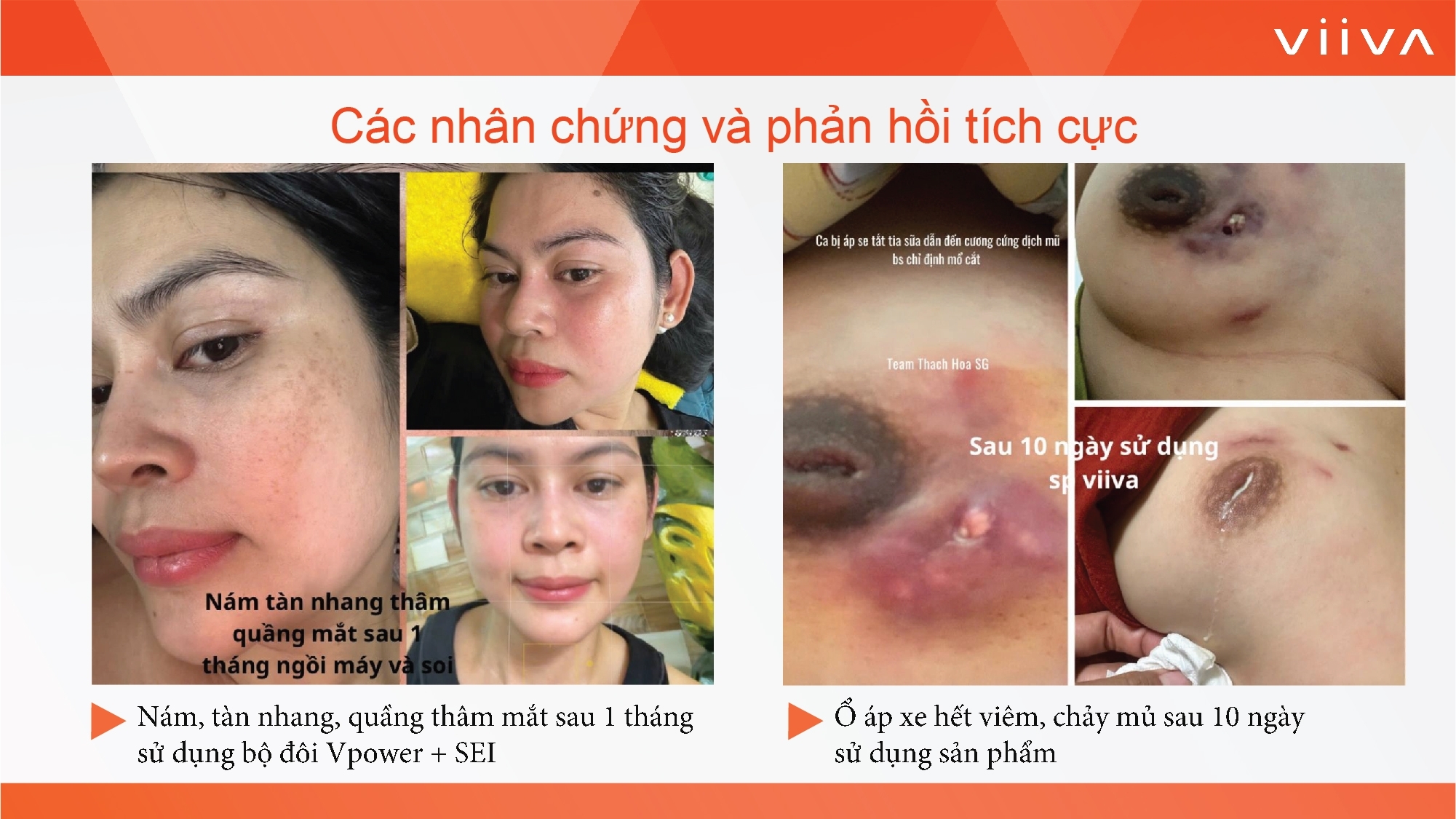 Sản phẩm Sản phẩm