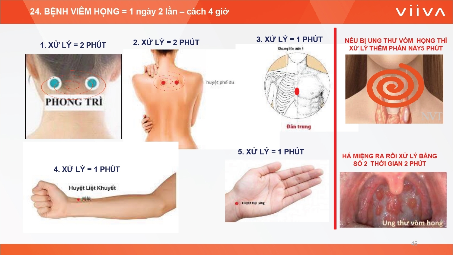 Sản phẩm Sản phẩm
