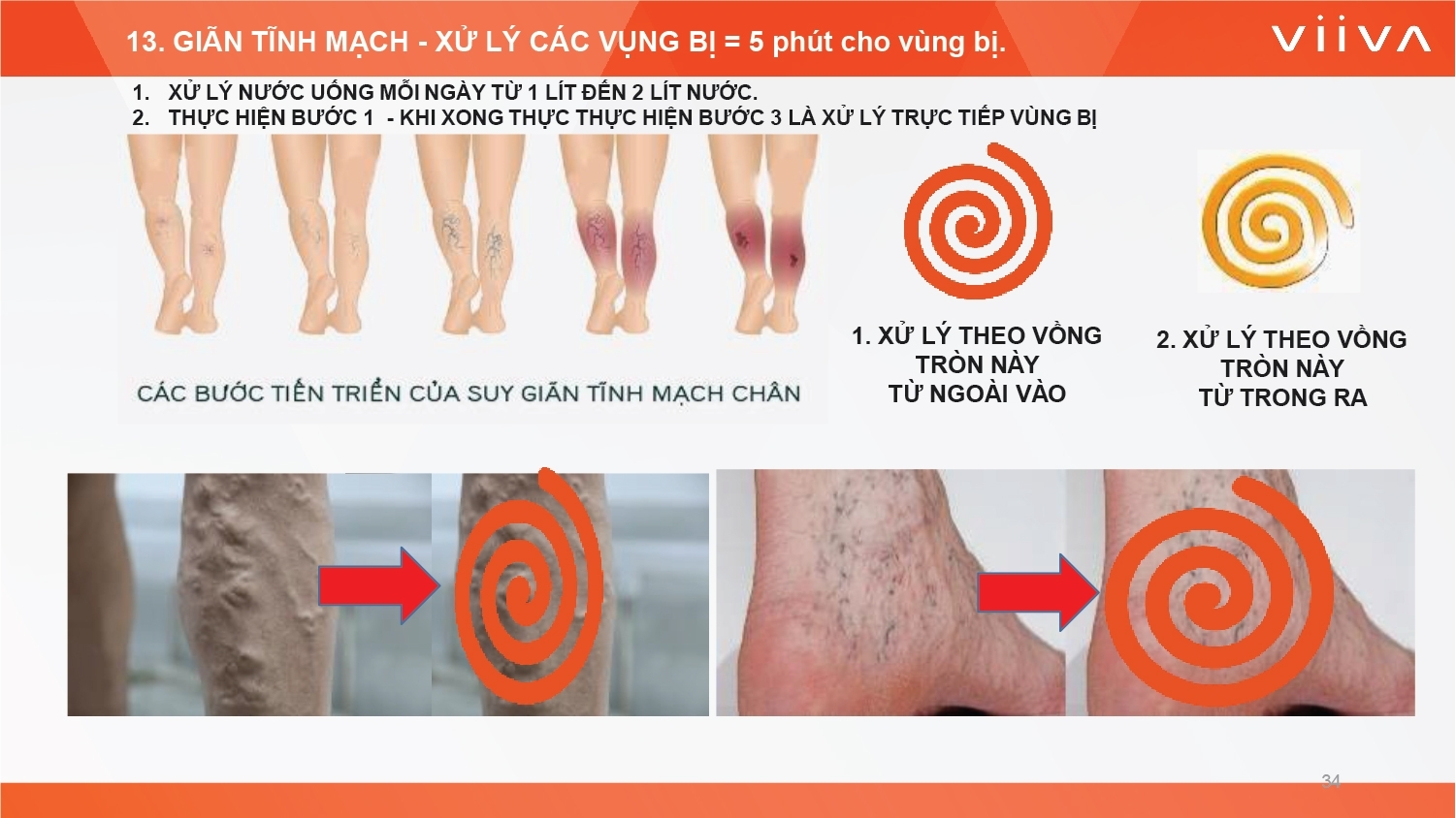 Sản phẩm Sản phẩm