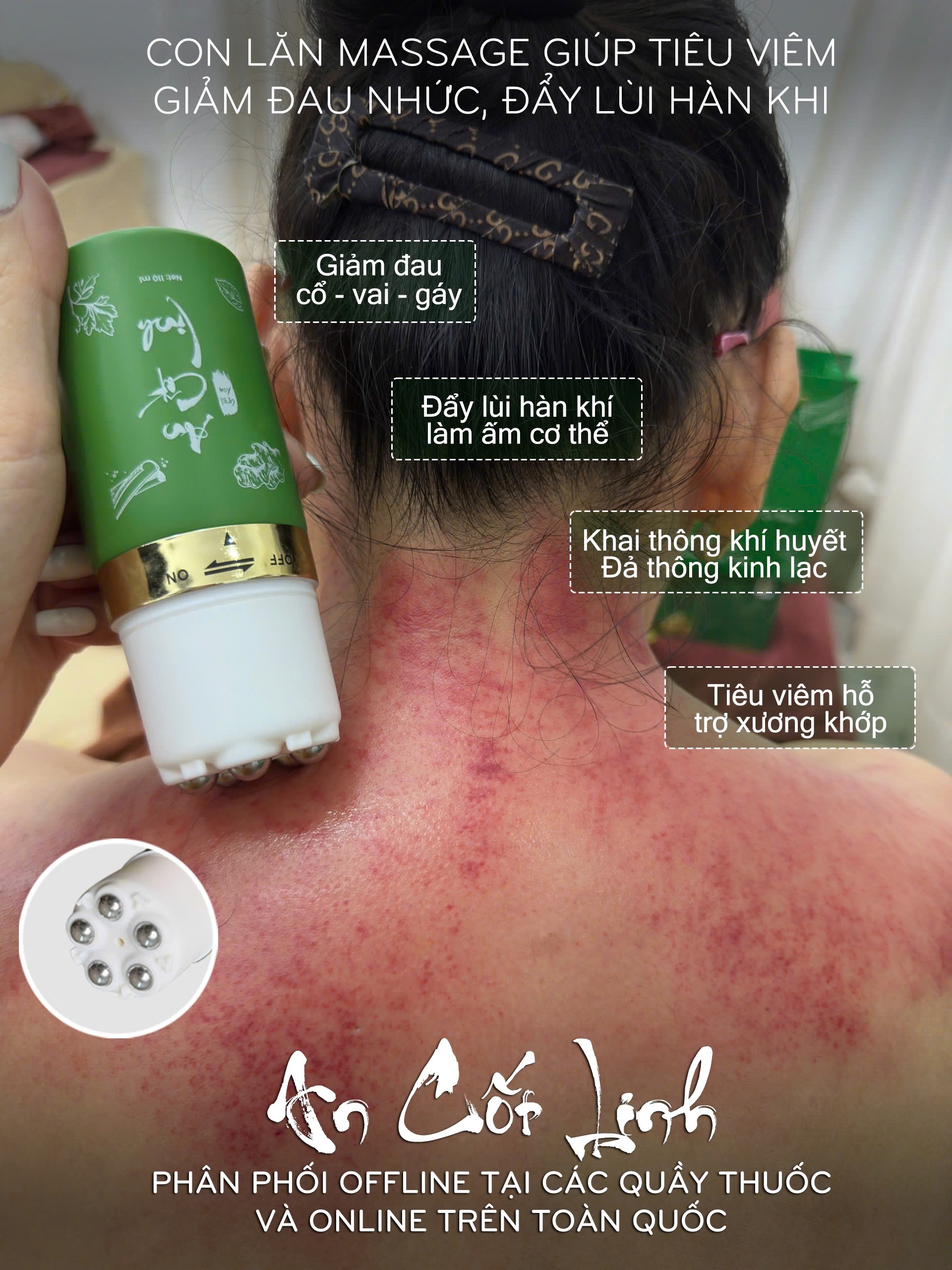 CON LĂN MASSAGE TRỊ LIỆU AN CỐT LINH